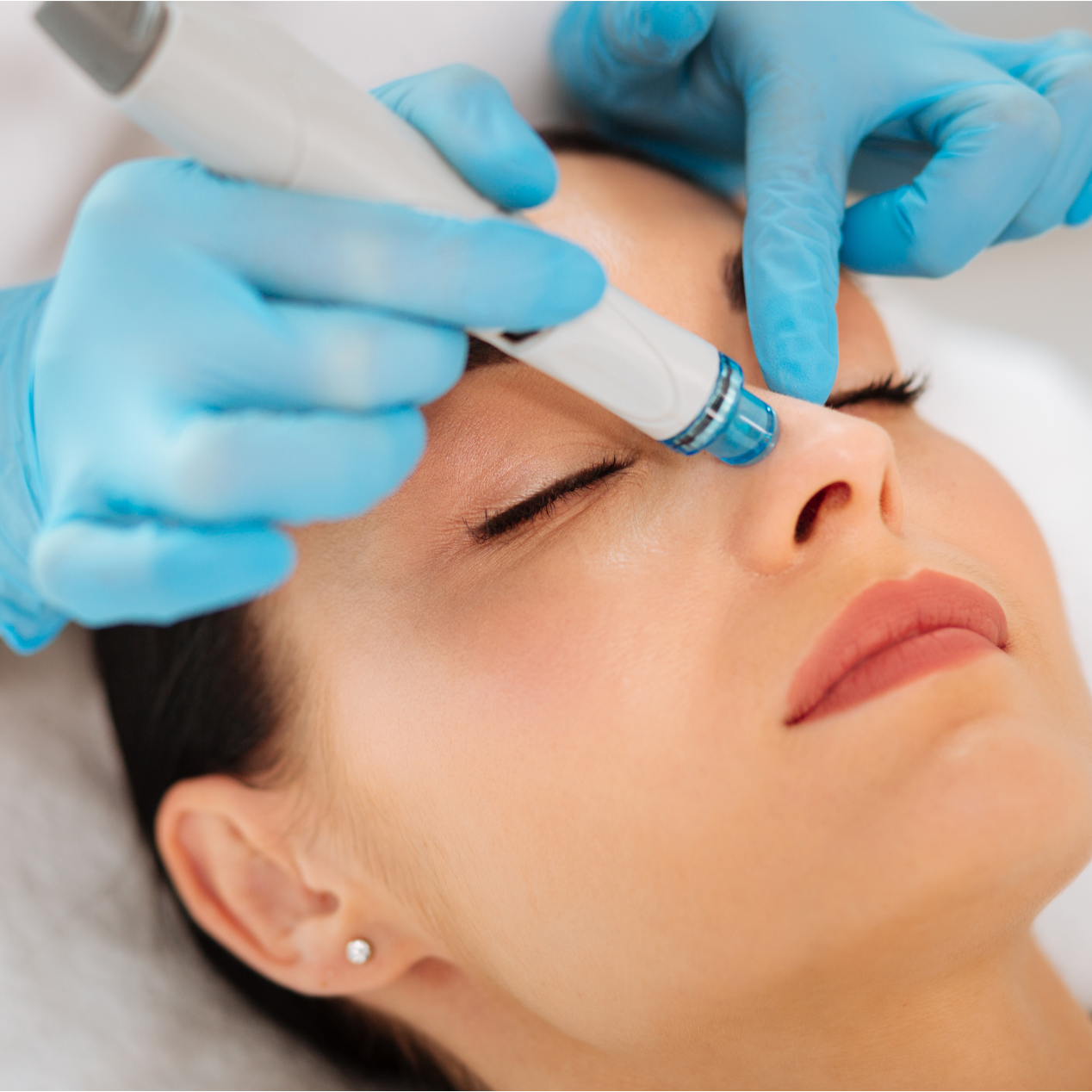 HydraFacial
